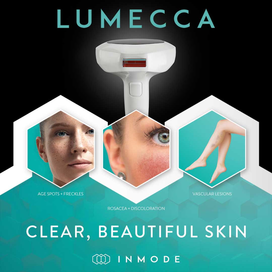 Lumecca Peak IPL - Skin Discoloration Correction